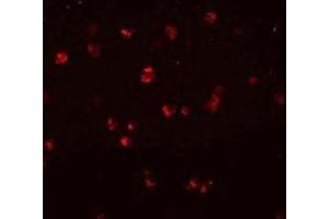 Immunofluorescencent staining of Jurkat cells with NLRC3 polyclonal antibody  at 20 ug/mL. (NLRC3 Antikörper  (Internal Region))