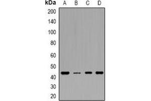 Western blot analysis of IDH3 gamma expression in HEK293T (A), MCF7 (B), mouse heart (C), rat heart (D) whole cell lysates. (IDH3G Antikörper)