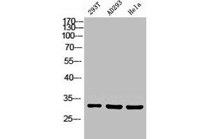 Western Blot analysis of 293T HELA using Carbonyl Reductase 1 Polyclonal Antibody. (CBR1 Antikörper  (Internal Region))