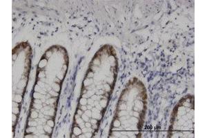 Image no. 1 for anti-Homeobox D11 (HOXD11) (AA 1-77) antibody (ABIN599383) (HOXD11 Antikörper  (AA 1-77))