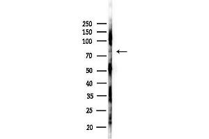 Western blot analysis of lysates from EC304 cells(starvation 24h treatment), using Phospho-Ezrin (Tyr478) Antibody at 1/1000 dilution.