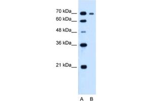 Western Blotting (WB) image for anti-Ribonucleotide Reductase M1 (RRM1) antibody (ABIN2462920) (RRM1 Antikörper)