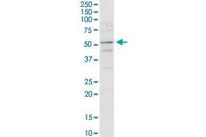 ACADM MaxPab rabbit polyclonal antibody. (Medium-Chain Specific Acyl-CoA Dehydrogenase, Mitochondrial (MCAD) (AA 1-421) Antikörper)