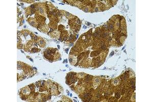 Immunohistochemistry of paraffin-embedded Human stomach using CETP Polyclonal Antibody (CETP Antikörper)