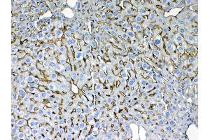 Immunohistochemistry (IHC) image for anti-Keratin 8 (KRT8) (AA 107-325) antibody (ABIN5518853)