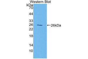 Western Blotting (WB) image for anti-Histidine-Rich Glycoprotein (HRG) (AA 106-302) antibody (ABIN1868417)