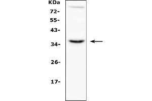 Western blot analysis of CD40L using anti-CD40L antibody (ABIN5692813). (CD40 Ligand Antikörper  (AA 107-260))