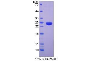 Image no. 1 for Myosin Light Chain Kinase 2 (MYLK2) (AA 327-536) protein (His tag) (ABIN4989828) (MYLK2 Protein (AA 327-536) (His tag))