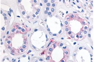 Human Kidney (formalin-fixed, paraffin-embedded) stained with EPHX2 antibody ABIN290080 at 20 ug/ml followed by biotinylated goat anti-rabbit IgG secondary antibody ABIN481713, alkaline phosphatase-streptavidin and chromogen. (EPHX2 Antikörper  (Internal Region))