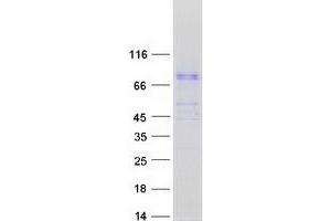 Western Blotting (WB) image for Bardet-Biedl Syndrome 7 (BBS7) (Transcript Variant 2) protein (Myc-DYKDDDDK Tag) (ABIN2715168)
