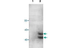 Western blot analysis of human fetal muscle lysate with PARP11 polyclonal antibody  at 1 : 200 dilution. (PARP11 Antikörper  (C-Term))