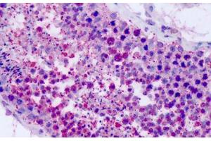 Immunohistochemistry (IHC) image for anti-Purinergic Receptor P2Y, G-Protein Coupled, 8 (P2RY8) (Cytoplasmic Domain) antibody (ABIN1049222)