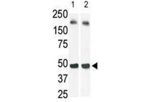 The anti-SphK1 Pab is used in Western blot (Lane 2) to detect c-myc-tagged SphK1 in transfected 293 cell lysate (a c-myc antibody is used as control in Lane 1). (SPHK1 Antikörper  (N-Term))