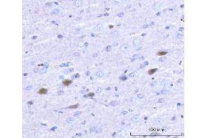 IHC analysis of Adgrg1 using anti-Adgrg1 antibody (ABIN7601979). (Adhesion G Protein-Coupled Receptor G1 (ADGRG1) (AA 53-554) Antikörper)
