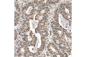 IHC analysis of SNRPD2 using anti-SNRPD2 antibody (ABIN7598963).