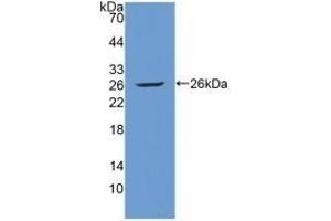 Detection of Recombinant Tie1, Human using Polyclonal Antibody to Tyrosine Kinase With Immunoglobulin Like And EGF Like Domains Protein 1 (Tie1)