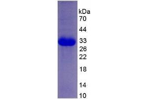 Image no. 1 for Eukaryotic Translation Initiation Factor 2-alpha Kinase 2 (EIF2AK2) (AA 224-502) (Active) protein (His tag) (ABIN6239876)