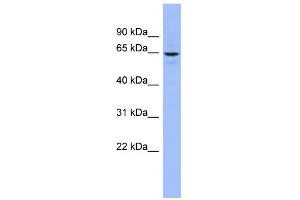WB Suggested Anti-SLC34A3 Antibody Titration:  0. (SLC34A3 Antikörper  (Middle Region))