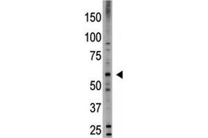 Western blot testing of BMP6 antibody and HL-60 cell lysate (BMP6 Antikörper  (AA 25-55))