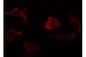 ABIN6275370 staining  Hela cells by IF/ICC. (KCNK1 Antikörper  (N-Term))