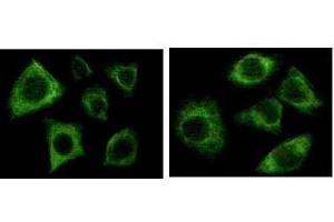 Immunofluorescence staining of methanol-fixed Eca-109 (left) and HepG2 (right) cells showing cytoplasmic localization.