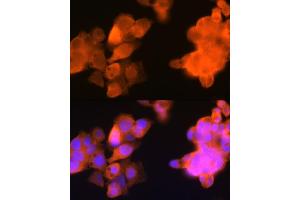 Immunofluorescence (IF) image for anti-Aldo-Keto Reductase Family 1, Member C3 (3-alpha Hydroxysteroid Dehydrogenase, Type II) (AKR1C3) antibody (ABIN1680027)