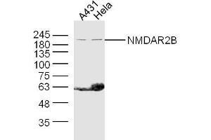 Lane 1: A431 lysates Lane 2: Hela lysates probed with NMDAR2B Polyclonal Antibody, Unconjugated  at 1:300 dilution and 4˚C overnight incubation. (GRIN2B Antikörper  (AA 451-550))
