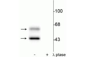 Western blot of rat brain lysate showing specific immunolabeling of the ~50 kDa α- and the ~60 kDa β-CaM Kinase II phosphorylated at Thr286 in the first lane (-). (CaMKII alpha/beta (pThr286) Antikörper)