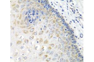 Immunohistochemistry of paraffin-embedded Human esophagus using STXBP4 Polyclonal Antibody at dilution of 1:100 (40x lens). (STXBP4 Antikörper)