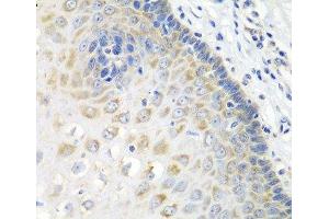 Immunohistochemistry of paraffin-embedded Human esophagus using STXBP4 Polyclonal Antibody at dilution of 1:100 (40x lens).
