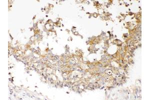Immunohistochemistry (IHC) image for anti-NDRG Family Member 3 (NDRG3) (AA 181-239) antibody (ABIN5518857)
