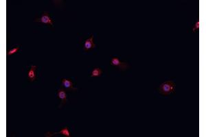 ABIN6267056 staining A-431 cells by IF/ICC. (Cyclin D1 Antikörper  (C-Term))