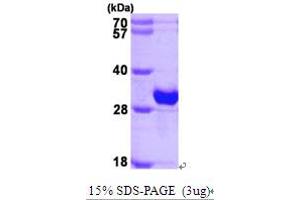 SDS-PAGE (SDS) image for Crystallin, beta B1 (CRYBB1) (AA 1-252) protein (His tag) (ABIN667015)