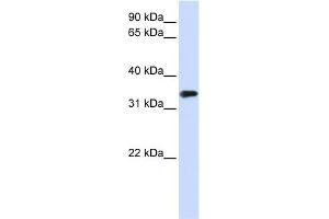 WB Suggested Anti-MBD3 Antibody Titration:  0.