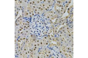Immunohistochemistry of paraffin-embedded rat kidney using SQSTM1 Antibody. (SQSTM1 Antikörper)