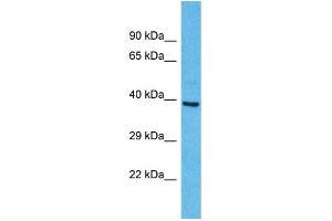 Western Blotting (WB) image for anti-Olfactory Receptor, Family 2, Subfamily A, Member 25 (OR2A25) (C-Term) antibody (ABIN2791720) (OR2A25 Antikörper  (C-Term))