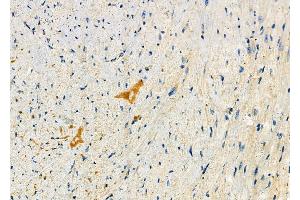 ABIN6264230 and ABIN6278621 at 1/100 staining Mouse heart tissue by IHC-P.