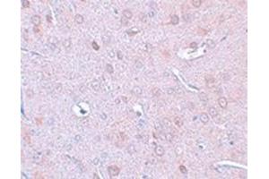 Immunohistochemical staining of rat brain tissue with DCLK1 polyclonal antibody  at 25 ug/mL dilution.