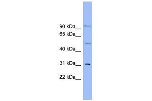 WB Suggested Anti-SLC25A25 Antibody Titration:  0. (SLC25A25 Antikörper  (N-Term))