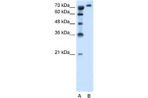 WB Suggested Anti-SLC6A18 Antibody Titration:  1. (SLC6A18 Antikörper  (Middle Region))