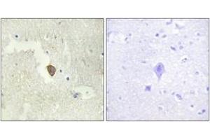 Immunohistochemistry analysis of paraffin-embedded human brain tissue, using ADCY7 Antibody. (ADCY7 Antikörper  (AA 191-240))