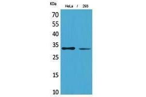 Western Blotting (WB) image for anti-Succinate Dehydrogenase Complex, Subunit B, Iron Sulfur (Ip) (SDHB) (Internal Region) antibody (ABIN3187945) (SDHB Antikörper  (Internal Region))