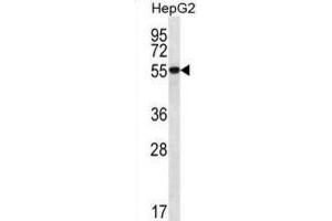 Western Blotting (WB) image for anti-UDP-Glucose 6-Dehydrogenase (UGDH) antibody (ABIN2996851) (UGDH Antikörper)