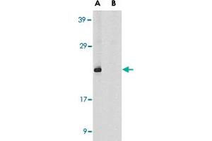Western blot analysis of DIABLO in human heart tissue lysate in the absence (A) or presence (B) of blocking peptide with DIABLO polyclonal antibody  at 1 ug /mL .