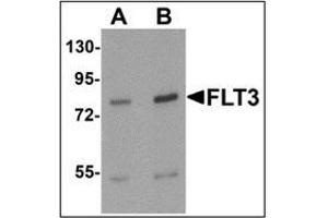 Western blot analysis of FLT3 in 3T3 cell lysate with FLT3 antibody at (A) 1 and (B)2 ug/mL. (FLT3 Antikörper  (N-Term))