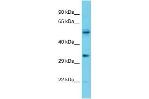 Host: Rabbit Target Name: OR5V1 Sample Type: Jurkat Whole Cell lysates Antibody Dilution: 1. (OR5V1 Antikörper  (C-Term))