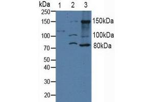 Western blot analysis of (1) Human Serum, (2) Human 293T Cells and (3) Human A431 Cells. (ITGA2 Antikörper  (AA 678-894))