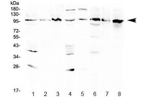 Western blot testing of 1) rat brain, 2) rat kidney, 3) rat NRK, 4) mouse brain, 5) mouse kidney, 6) human HeLa, 7) human Jurkat and 8) human K562 lysate with AGO1 antibody at 0. (AGO1 Antikörper  (AA 376-409))