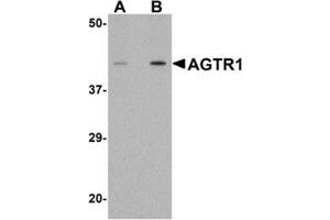 Western blot analysis of AGTR1 in mouse kidney tissue lysate with AGTR1 antibody at (A) 1 and (B) 2 μg/ml. (Angiotensin II Type-1 Receptor Antikörper  (Center))