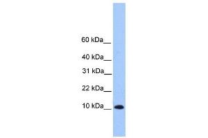 TRAPPC6B antibody used at 1 ug/ml to detect target protein. (TRAPPC6B Antikörper  (Middle Region))